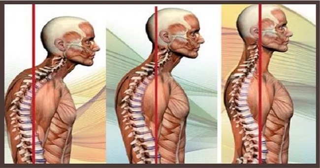 5 Simple Yoga Poses To Improve Posture And Get Relief From Neck And